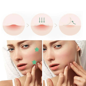 Reveal Your Radiance, Embrace Skin Confidence